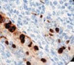 Adenovirus Antibody (clone 20/11 and 2/6)