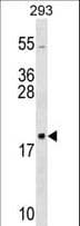 Polyclonal Rabbit anti-Human RPL26 / Ribosomal Protein L26 Antibody (aa98-127, WB)