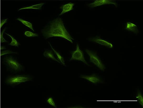 Monoclonal Mouse anti-Human CREBL1 / ATF6B Antibody (clone 4D10, IF, WB)