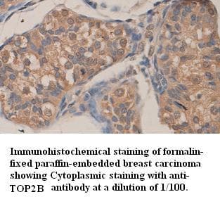 TOP2B / Topoisomerase II Beta Antibody (C-Terminus)