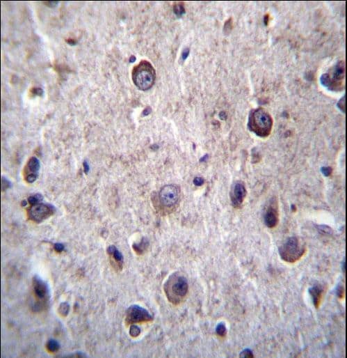 Polyclonal Rabbit anti-Human DOC2A Antibody (aa277-306, IHC, WB)