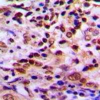 Polyclonal Rabbit anti-Human PDXDC1 Antibody (IHC, WB)
