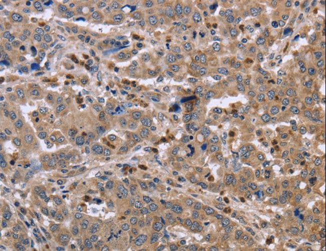 EDA / Ectodysplasin A Antibody