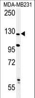 Polyclonal Rabbit anti-Human PHLPP2 / PHLPPL Antibody (aa1295-1323, IHC, WB)