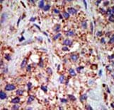 USP8 / UBPY Antibody (aa1058-1087)