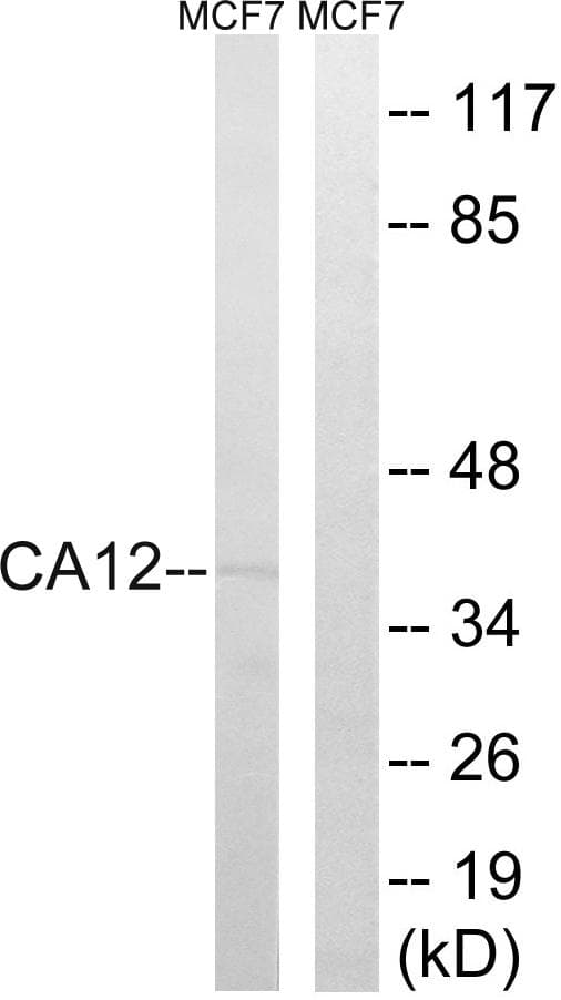 CA12 / Carbonic Anhydrase XII Antibody