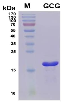 Human GCG / Glucagon Protein (Recombinant 6His, N-terminus)