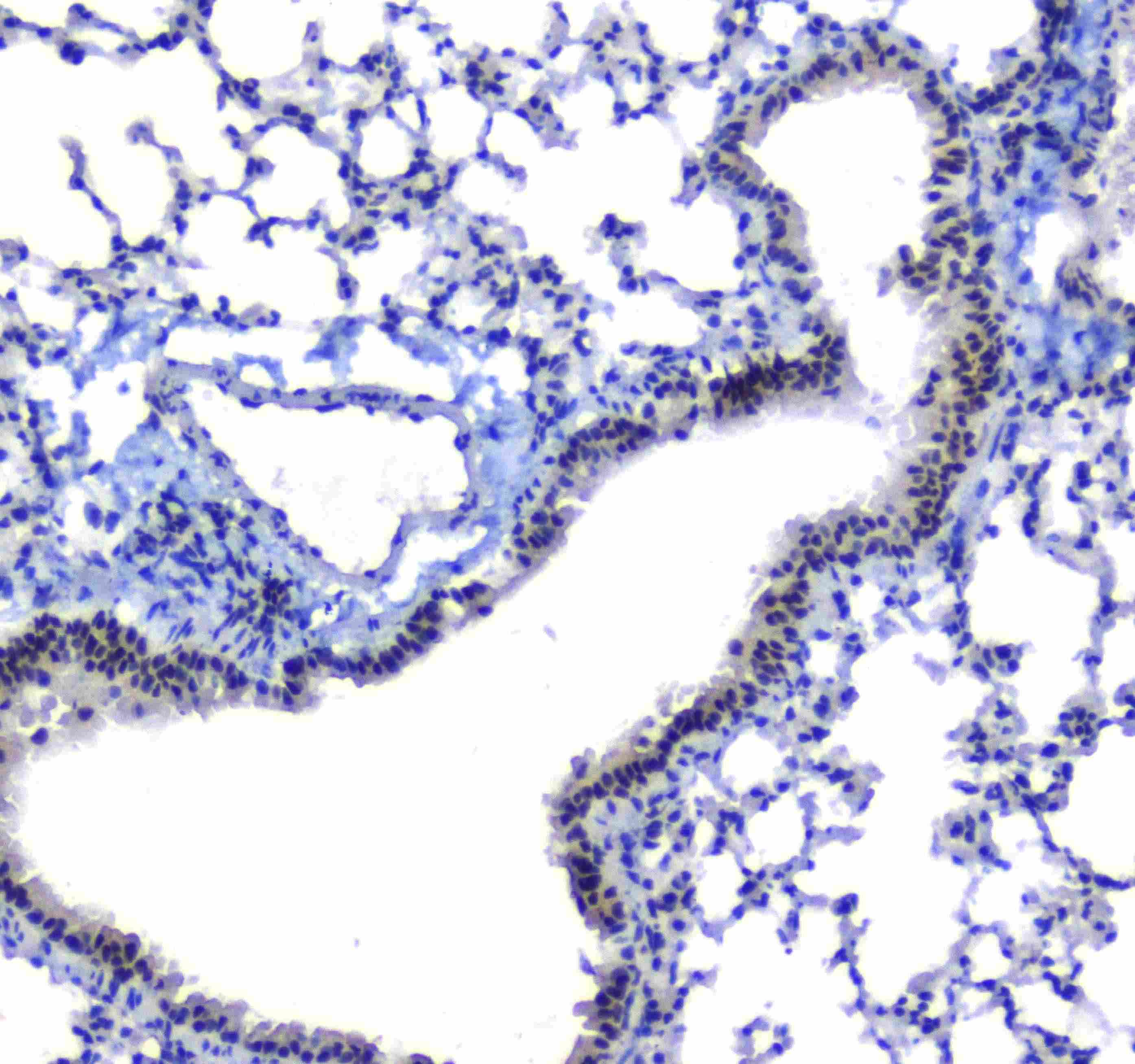 SF1 Antibody