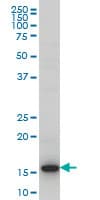 IHC-plus™ HIST1H3D Antibody (clone 1D8)