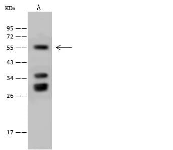 FETUB / Fetuin B Antibody