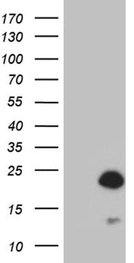 AGR2 Antibody (aa21-175, clone OTI2G8, Carrier-free)