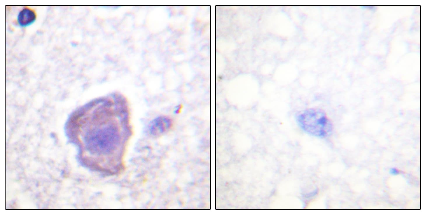 FAK / Focal Adhesion Kinase Antibody (aa876-925)