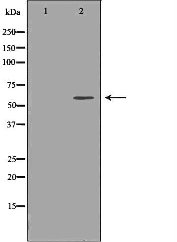 Polyclonal Rabbit anti-Human UGT1A9 Antibody (IHC, WB)