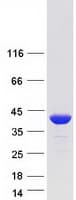 Human AKR7A3 Protein (Recombinant Myc-DDK (Flag))