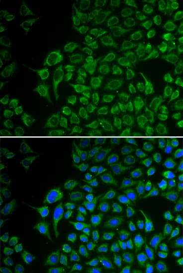 Tyrosinase Antibody