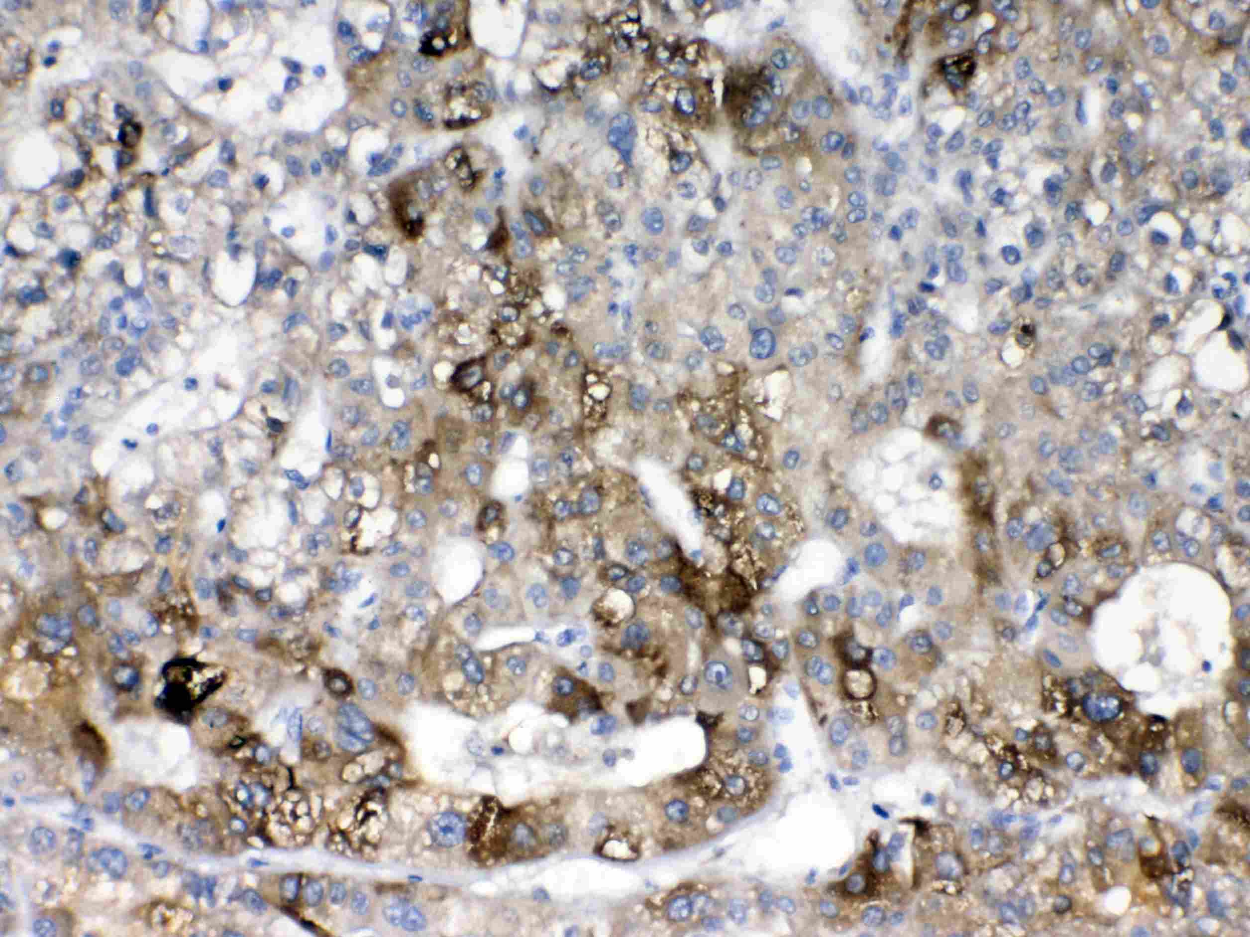 Polyclonal Rabbit anti-Human CYP2D6 Antibody (IHC, WB)