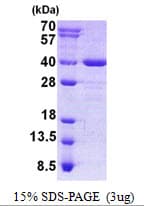 Human AIDA Protein (Recombinant His)