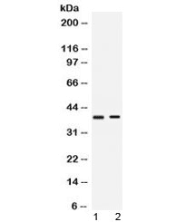 TNFRSF14 / CD270 / HVEM Antibody