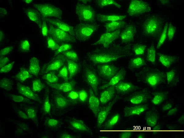 IHC-plus™ Monoclonal Mouse anti-Human CDKN1B / p27 Kip1 Antibody (clone 4B4-E6, IHC, IF, WB)