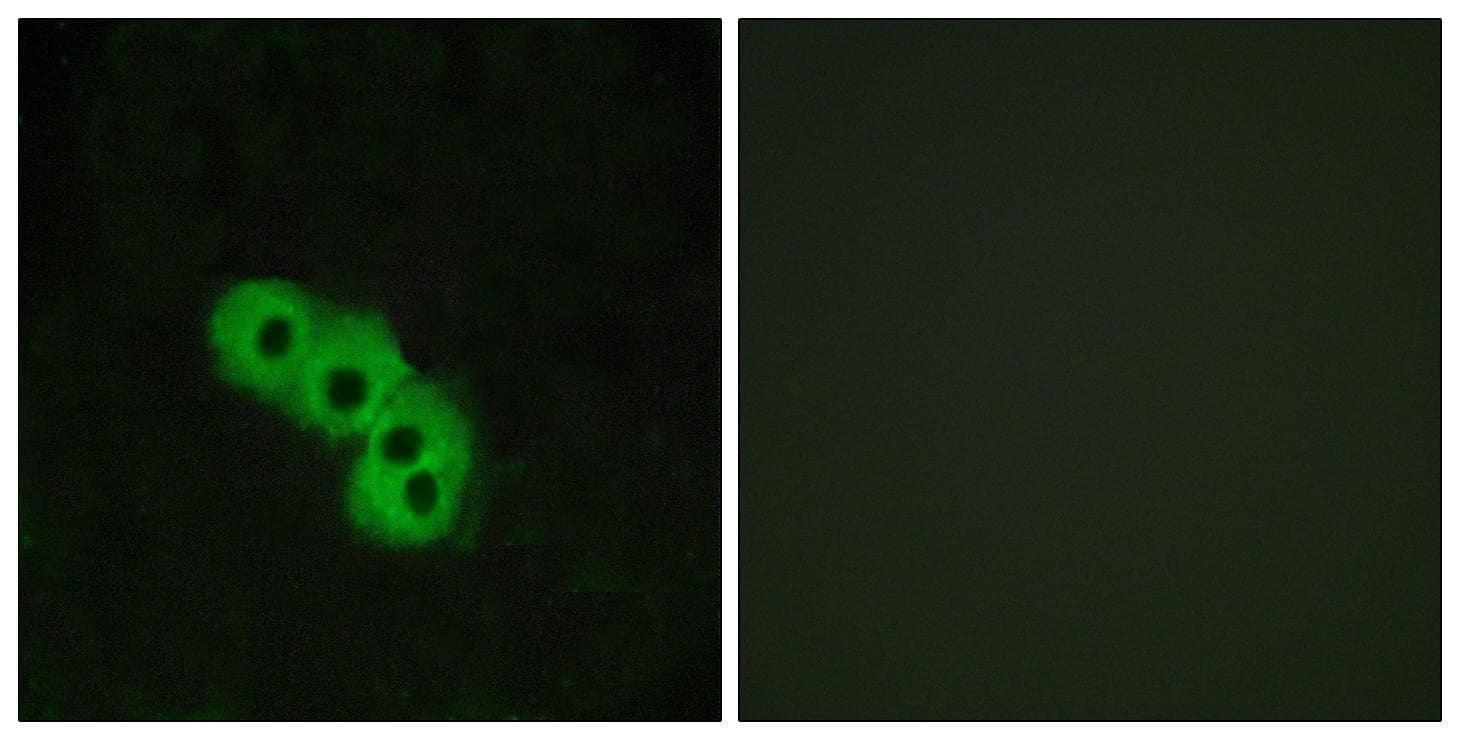 HCAR2 + HCAR3 / GPR109 Antibody