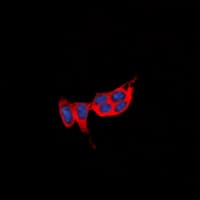 PROKR1 Antibody (N-Terminus)