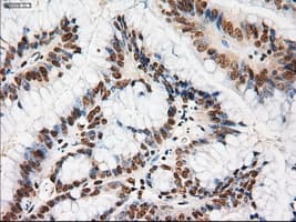 NOTCH1 Antibody (clone OTI3E12)