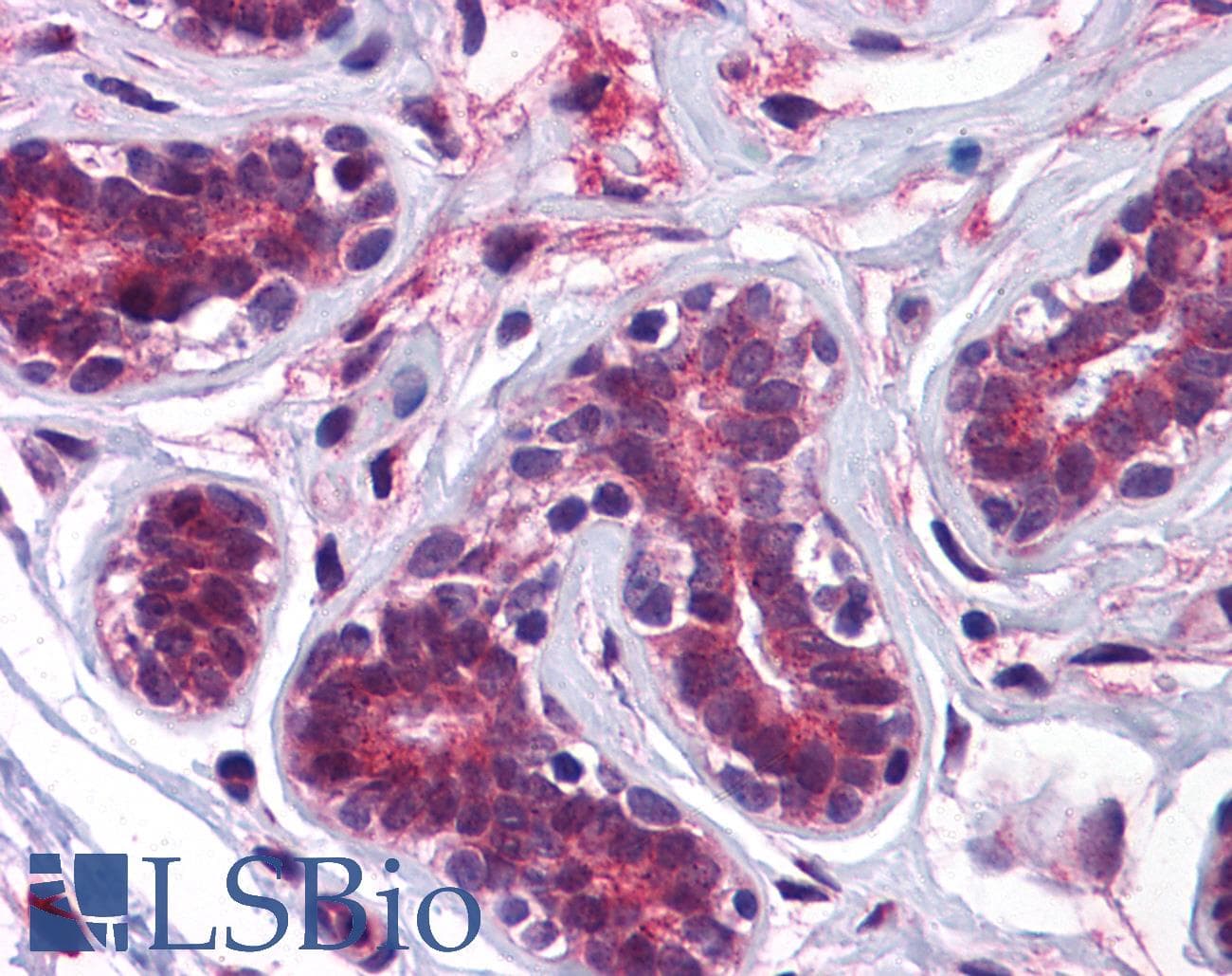 IHC-plus™ KPNA2 / Importin Alpha 1 Antibody