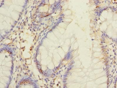 DIS3L Antibody