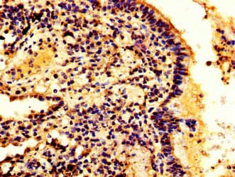 Polyclonal Rabbit anti-Human HMGB3 Antibody (IHC, WB)