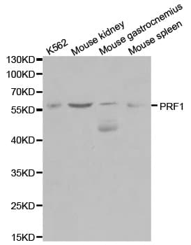 Polyclonal Rabbit anti-Human PRF1 / Perforin Antibody (IHC, IF, WB)