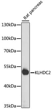 KLHDC2 / LCP Antibody