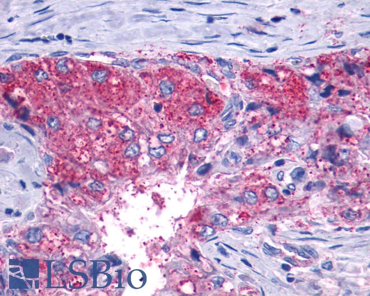 PathPlus™ Polyclonal Rabbit anti-Human LTB4R2 / BLT2 Antibody (C-Terminus, IHC)