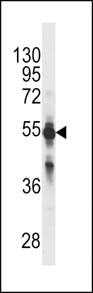 CYP2C9 / Cytochrome P450 2C9 Antibody (aa82-110)