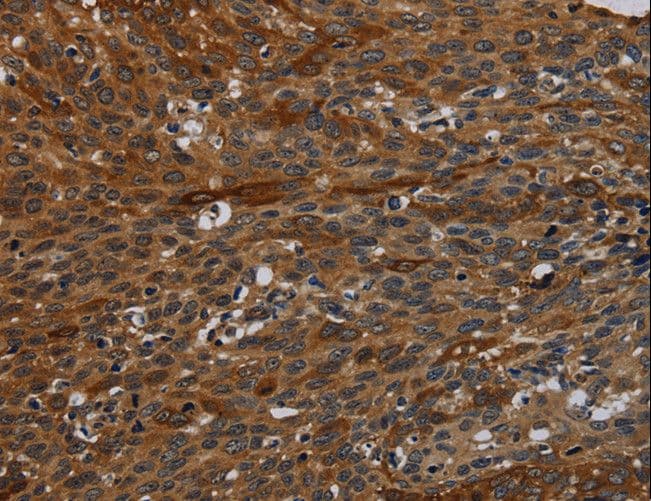IVL / Involucrin Antibody