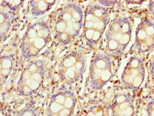 Polyclonal Rabbit anti-Human LYG1 Antibody