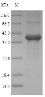 Human AMELX Protein (Recombinant 6His-SUMO, N-terminus)