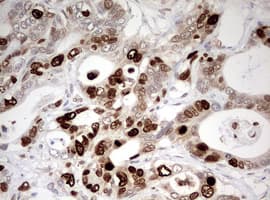 Monoclonal Mouse anti-Human TOP2A / Topoisomerase II Alpha Antibody (clone OTI2D12, aa1100-1531, IHC, WB)