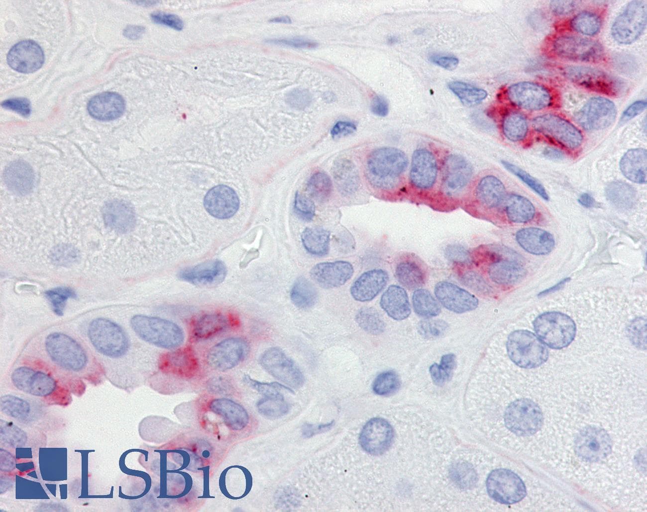 IHC-plus™ PTGER2 / EP2 Antibody (Cytoplasmic Domain)