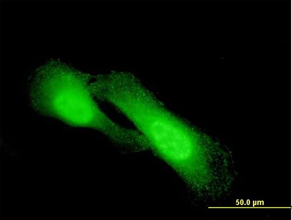 PathPlus™ Monoclonal Mouse anti-Human NDRG1 Antibody (clone 2D7, IHC, IF, WB)