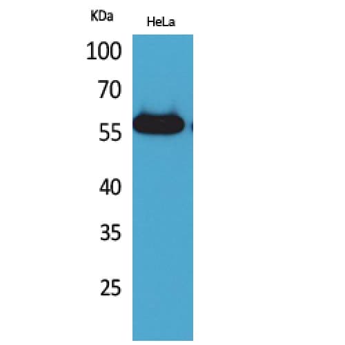 Polyclonal Rabbit anti-Human Amylase Antibody (61-110 aa, N-terminal, WB)