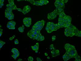 Heat Shock Protein 70 / HSPA1A Antibody (clone OTI2C12)