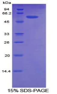Human ALCAM / CD166 Protein (Recombinant His)