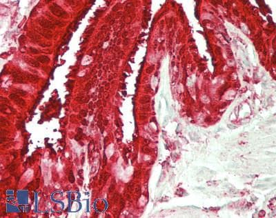 IHC-plus™ ALDH3A1 Antibody (clone 1B6)