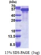 Human TRIM28 / KAP1 Protein (Recombinant His)