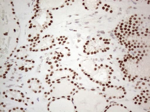 TP53BP1 / 53BP1 Antibody (aa1-300, clone OTI5E1)