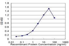 ZBTB16 / PLZF Antibody (clone 1F10)