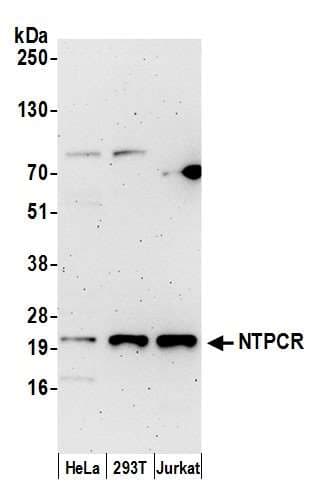 Polyclonal Rabbit anti-Human NTPCR / C1orf57 Antibody (aa1-50, WB)