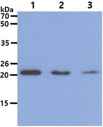 DHFR Antibody (clone AT5B2)