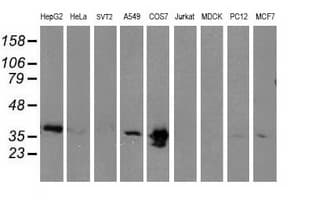 Monoclonal Mouse anti-Human MAPRE2 / EB2 Antibody (clone OTI7C10, IF, WB)