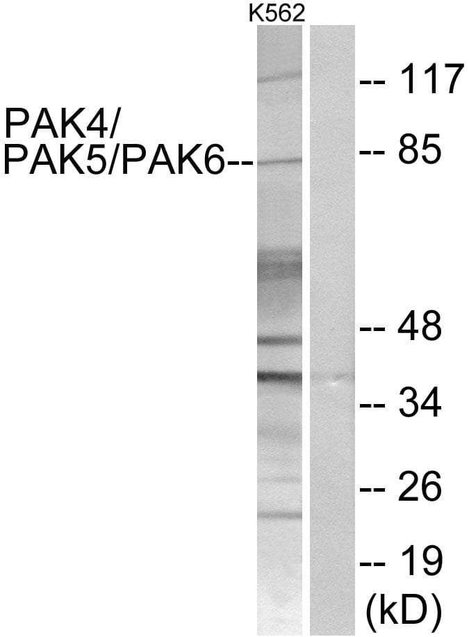 PAK4 + PAK5 + PAK6 Antibody (p474)